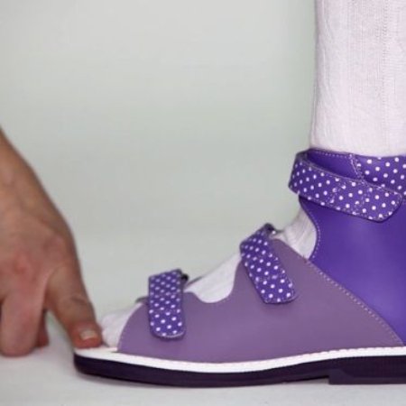 Какую обувь носить при плоскостопии? | Блог интернет-магазина ORTHOBOOM